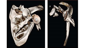 SI placeholder image_325x185.jpg