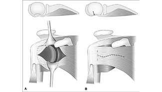 SI placeholder image_325x185.jpg