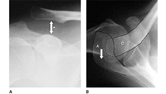 SI placeholder image_325x185.jpg