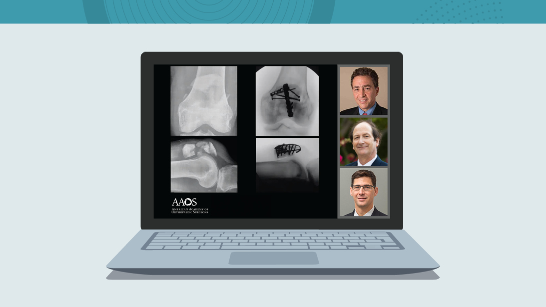 Common Fractures. Online Course Laptop